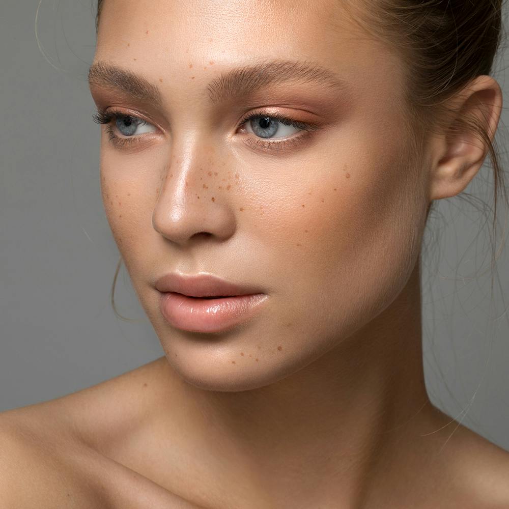 woman with freckles