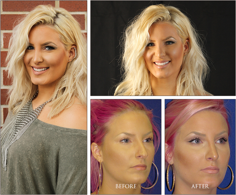 Liz's Before and After 