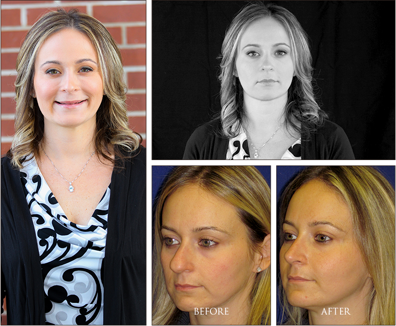 Karen's Before and Afters