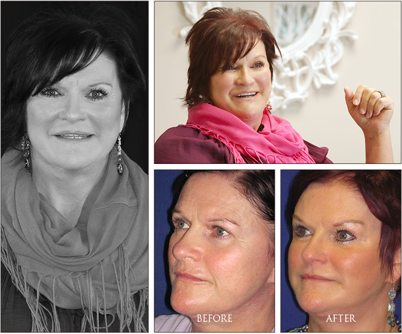 Rose's Before and Afters