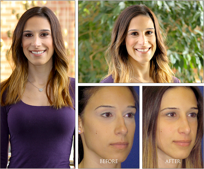 Alysia's Before and Afters