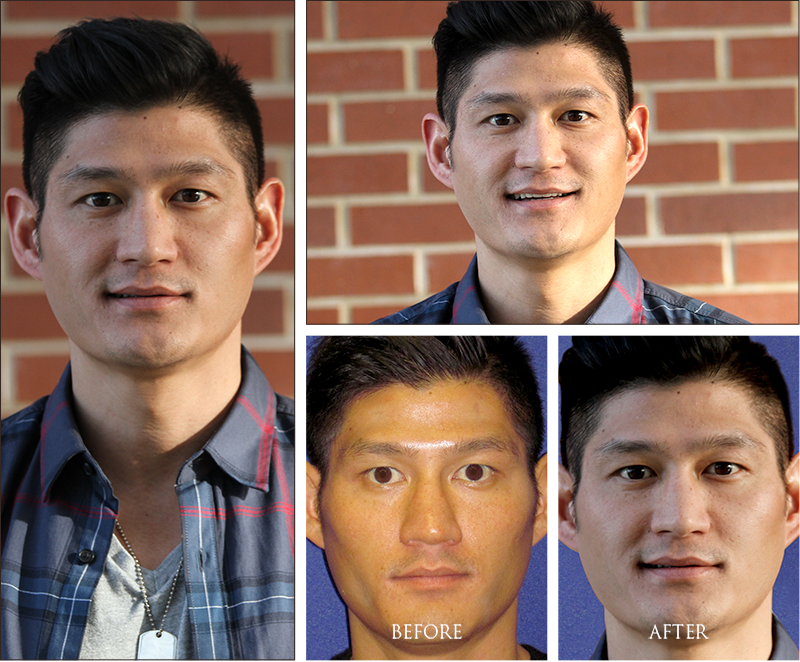 Joe's Before and Afters