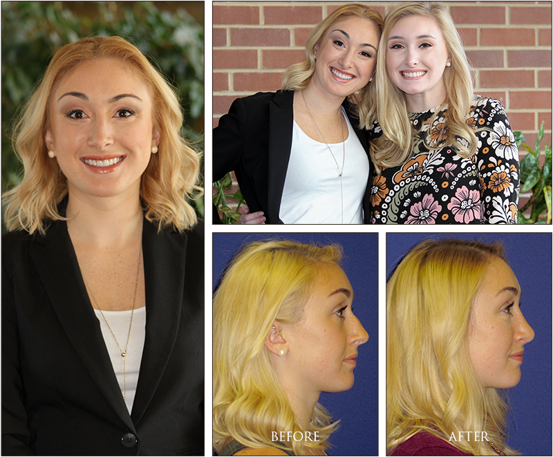 Emily’s Before and Afters