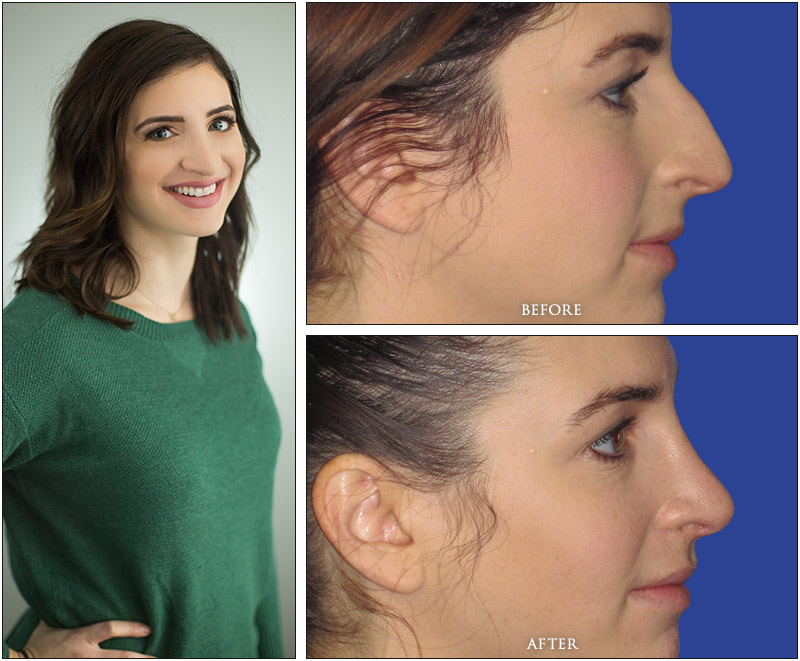 Brittany's Before and After