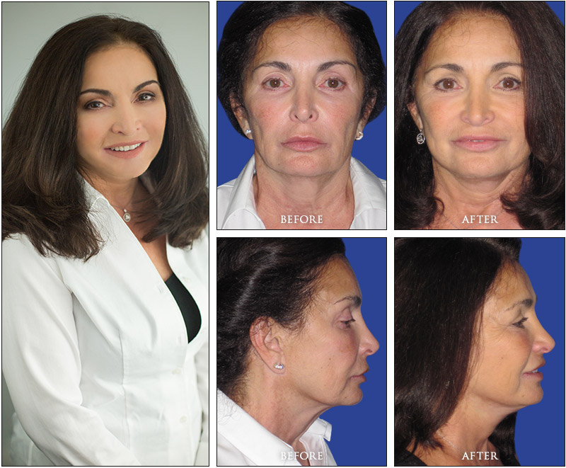 Pat's Before and Afters