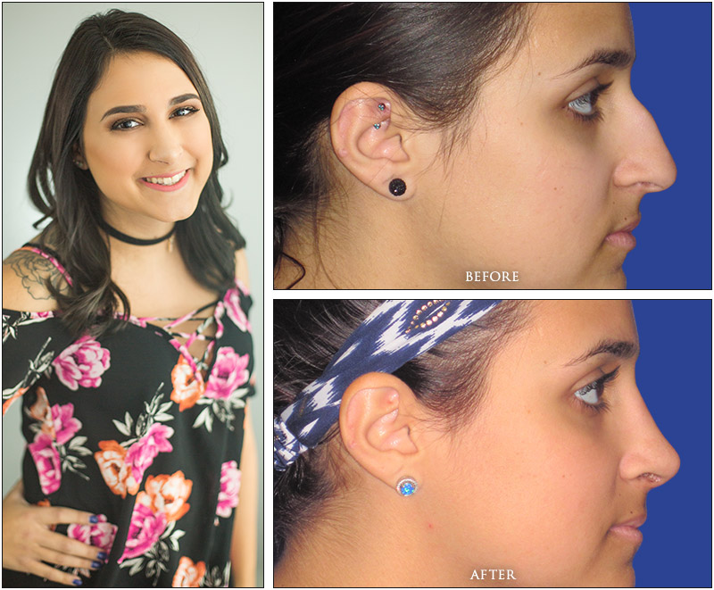 Christina’s Before and Afters