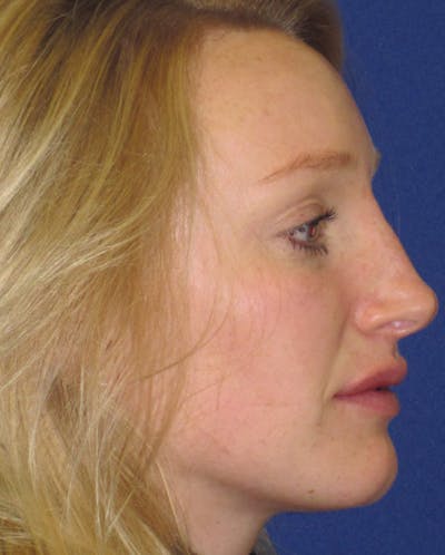 Non-Surgical 