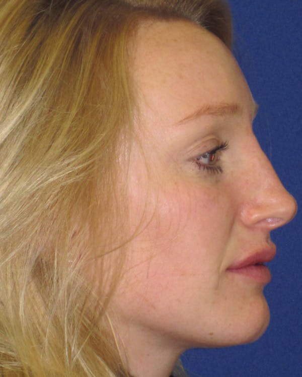 Non-Surgical 