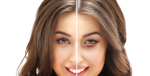blepharoplasty in philadelphia