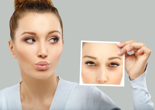 Blepharoplasty in Cherry HIll, New Jersey Blog