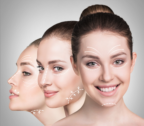 Facelift for younger patients