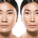 Corrado Facial Plastic Surgery Blog | How is an Asian Rhinoplasty Performed?