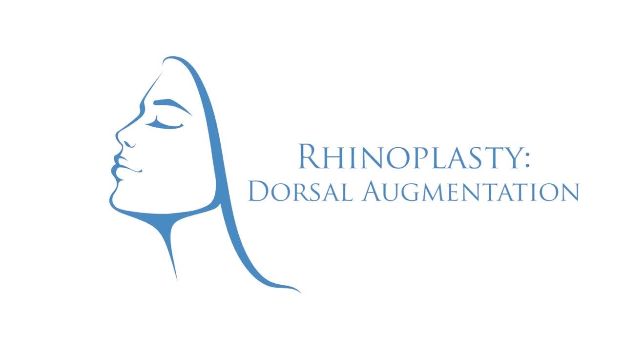 Rhinoplasty Dorsal Augmentation Visual