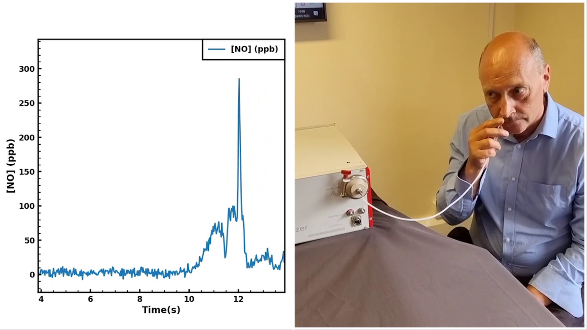 Fast response nitric oxide inhalation/exhalation measurements