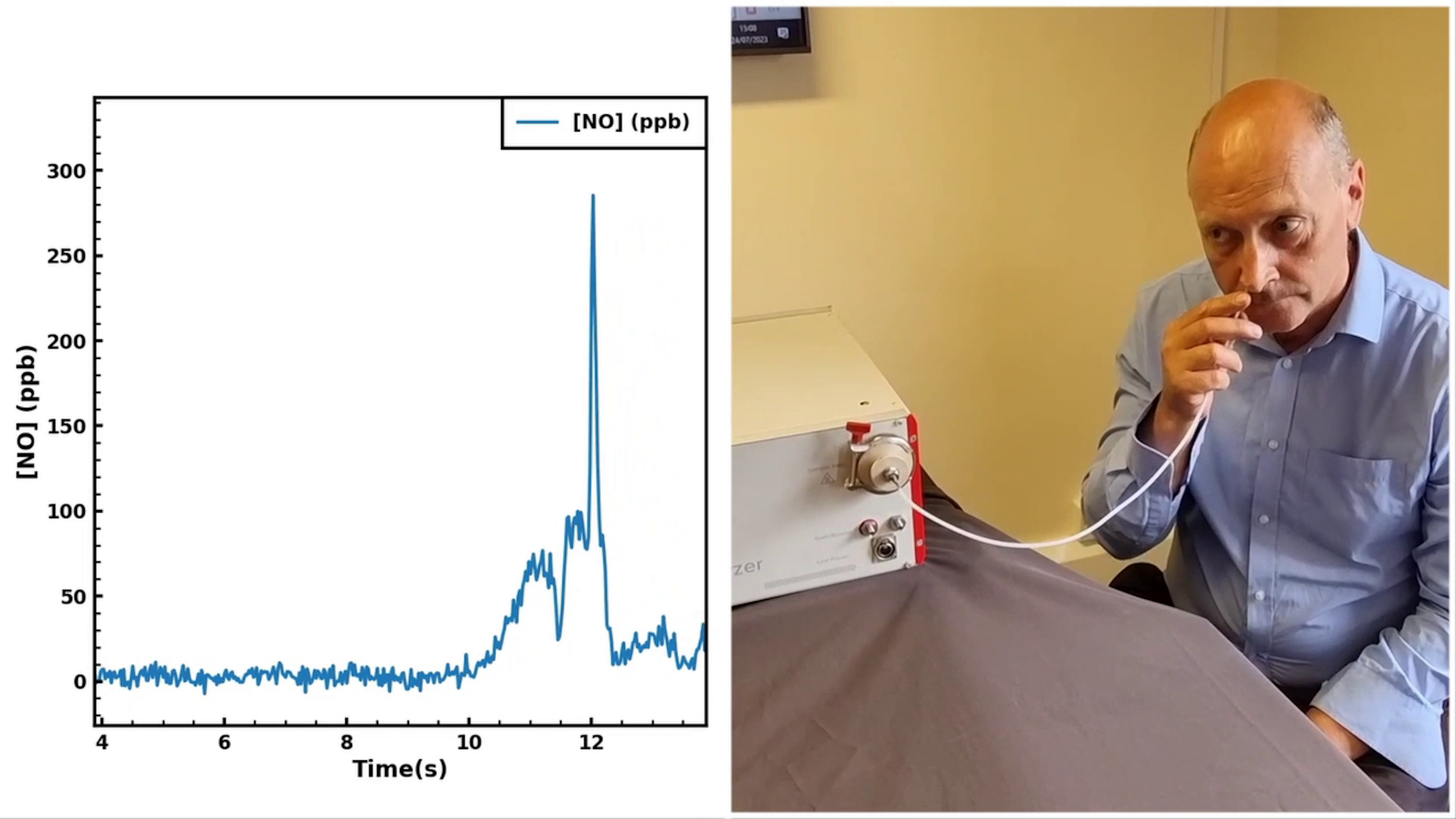 Subject exhaling nitric oxide