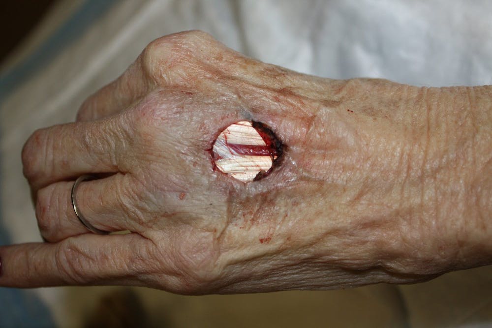 Extremity Reconstruction Before & After Gallery - Patient 5799833 - Image 1