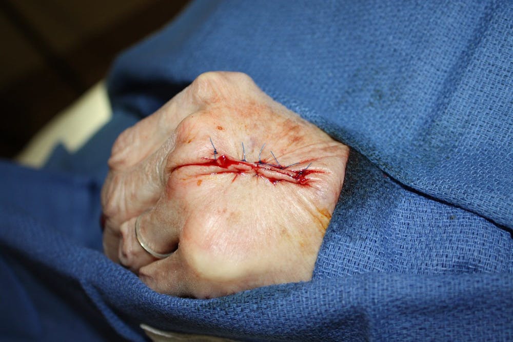 Extremity Reconstruction Before & After Gallery - Patient 5799833 - Image 2