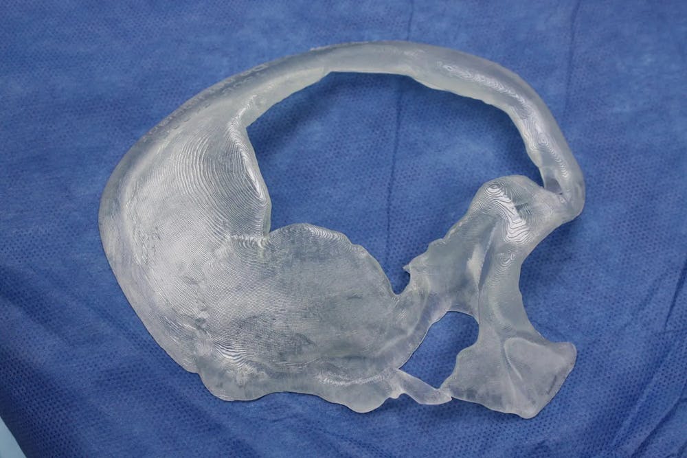 Facial and MOHS Reconstruction Before & After Gallery - Patient 5800822 - Image 15