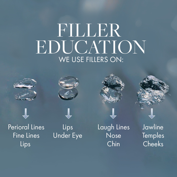 Filler education diagram image