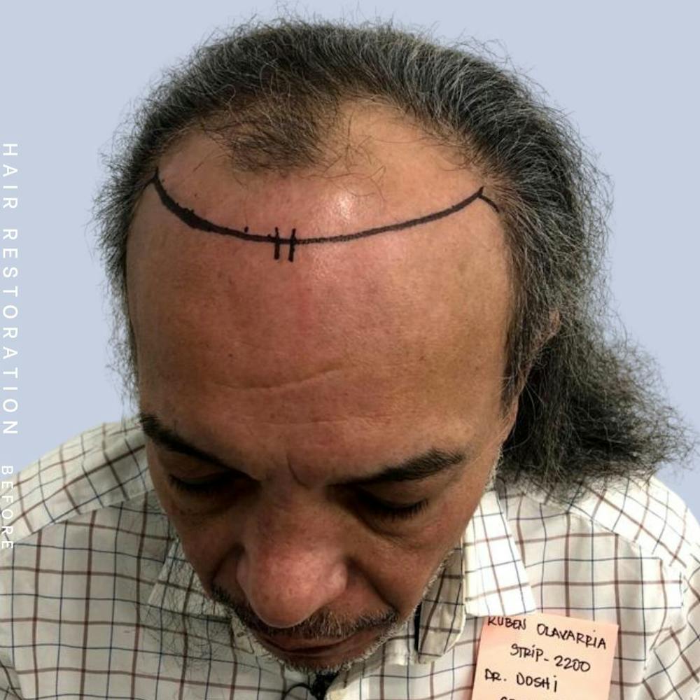 Hair Before & After Gallery - Patient 108745184 - Image 3