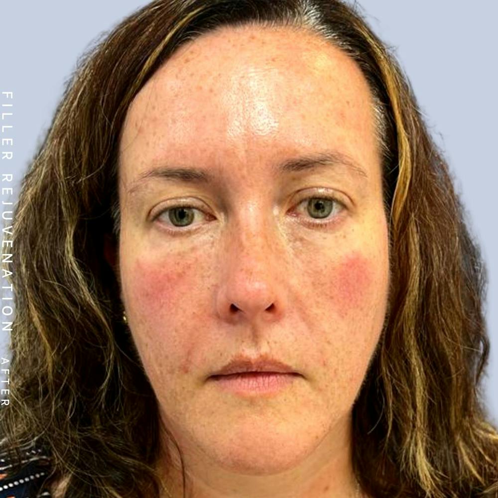 Global Before & After Gallery - Patient 123065088 - Image 2