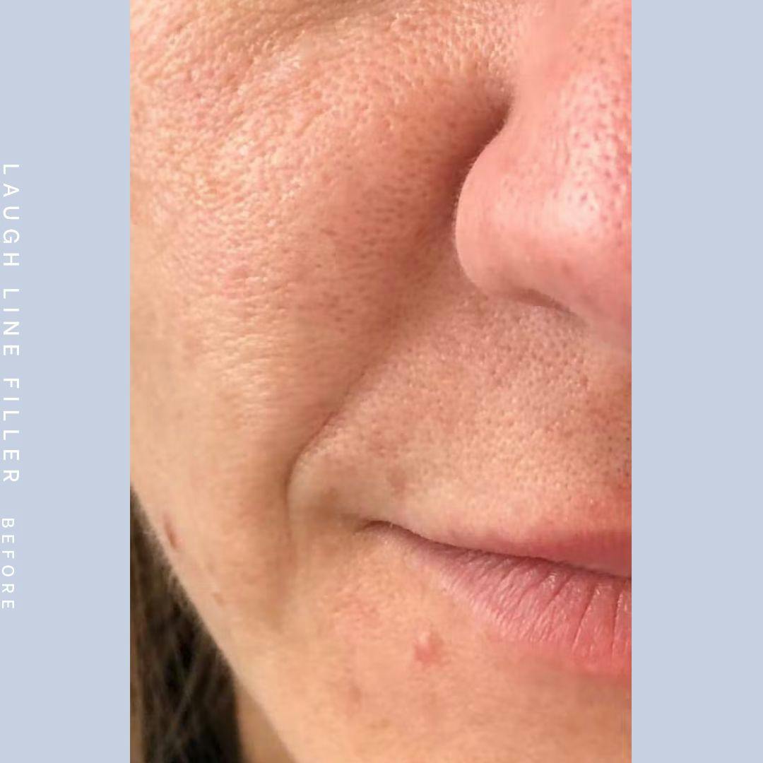 Mouth Before & After Gallery - Patient 121418566 - Image 1