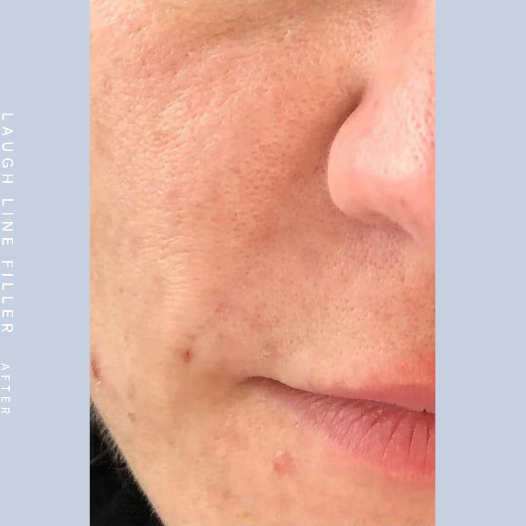 Mouth Before & After Gallery - Patient 121418566 - Image 2