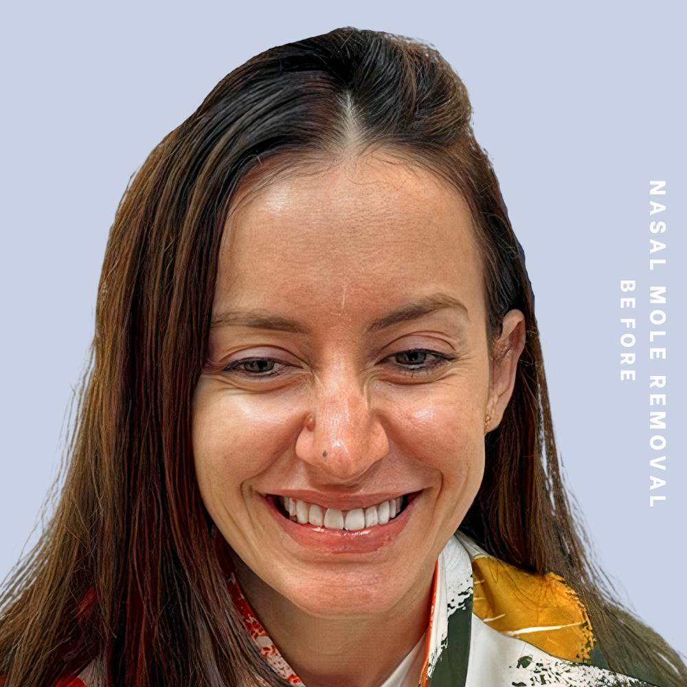 Other Before & After Gallery - Patient 146646072 - Image 1