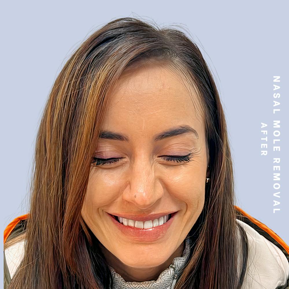 Other Before & After Gallery - Patient 146646072 - Image 2