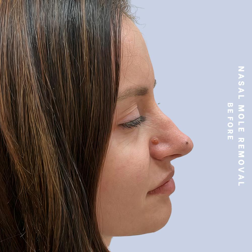 Other Before & After Gallery - Patient 146646072 - Image 3