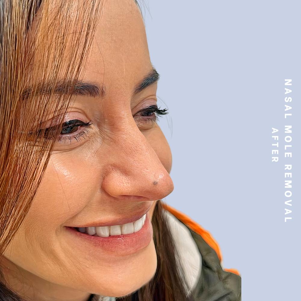 Other Before & After Gallery - Patient 146646072 - Image 6