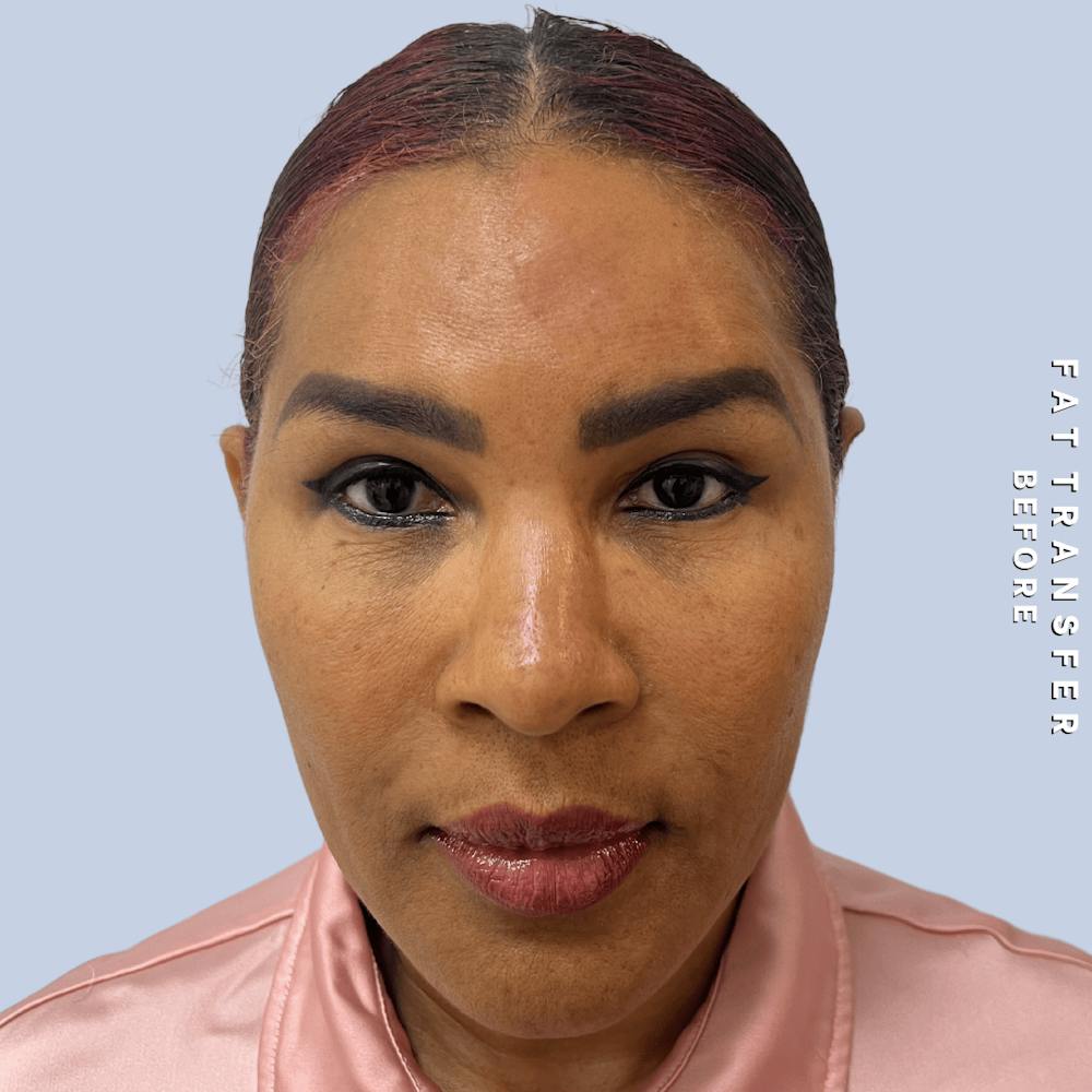 Other Before & After Gallery - Patient 277073 - Image 3