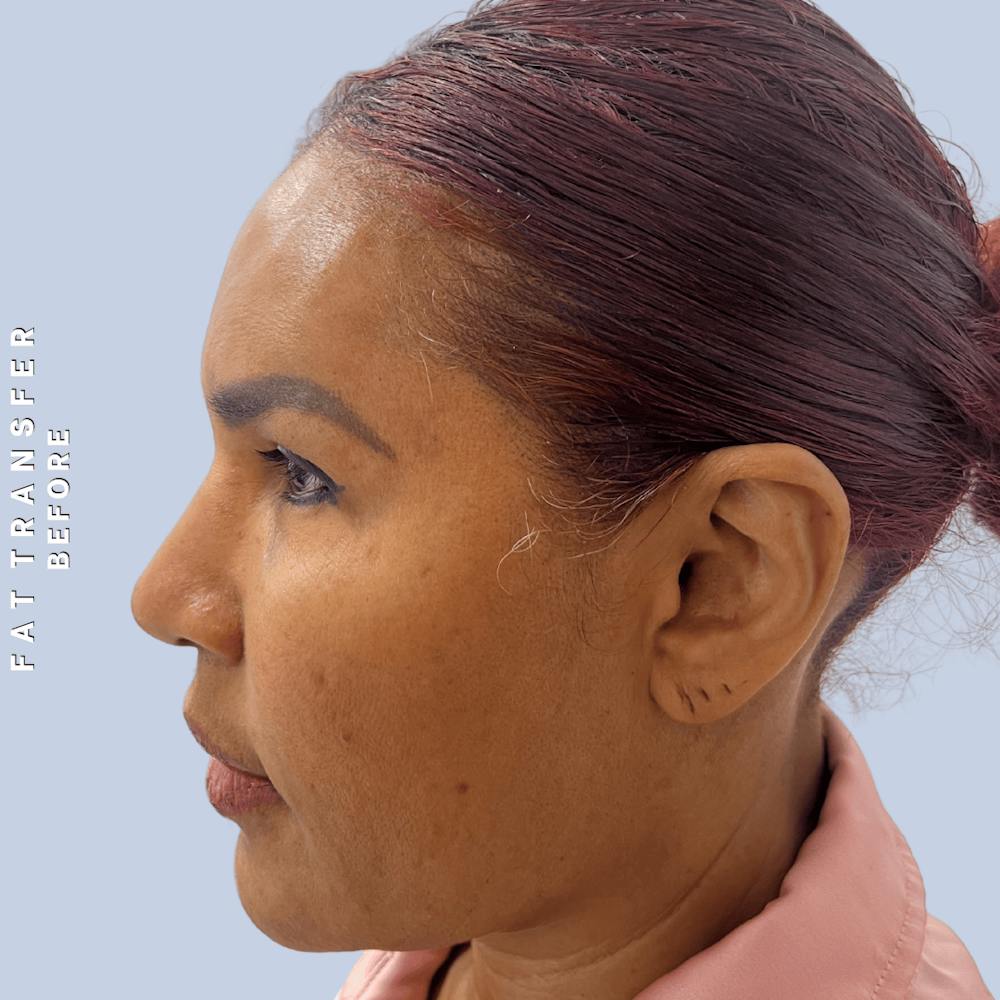 Other Before & After Gallery - Patient 277073 - Image 5