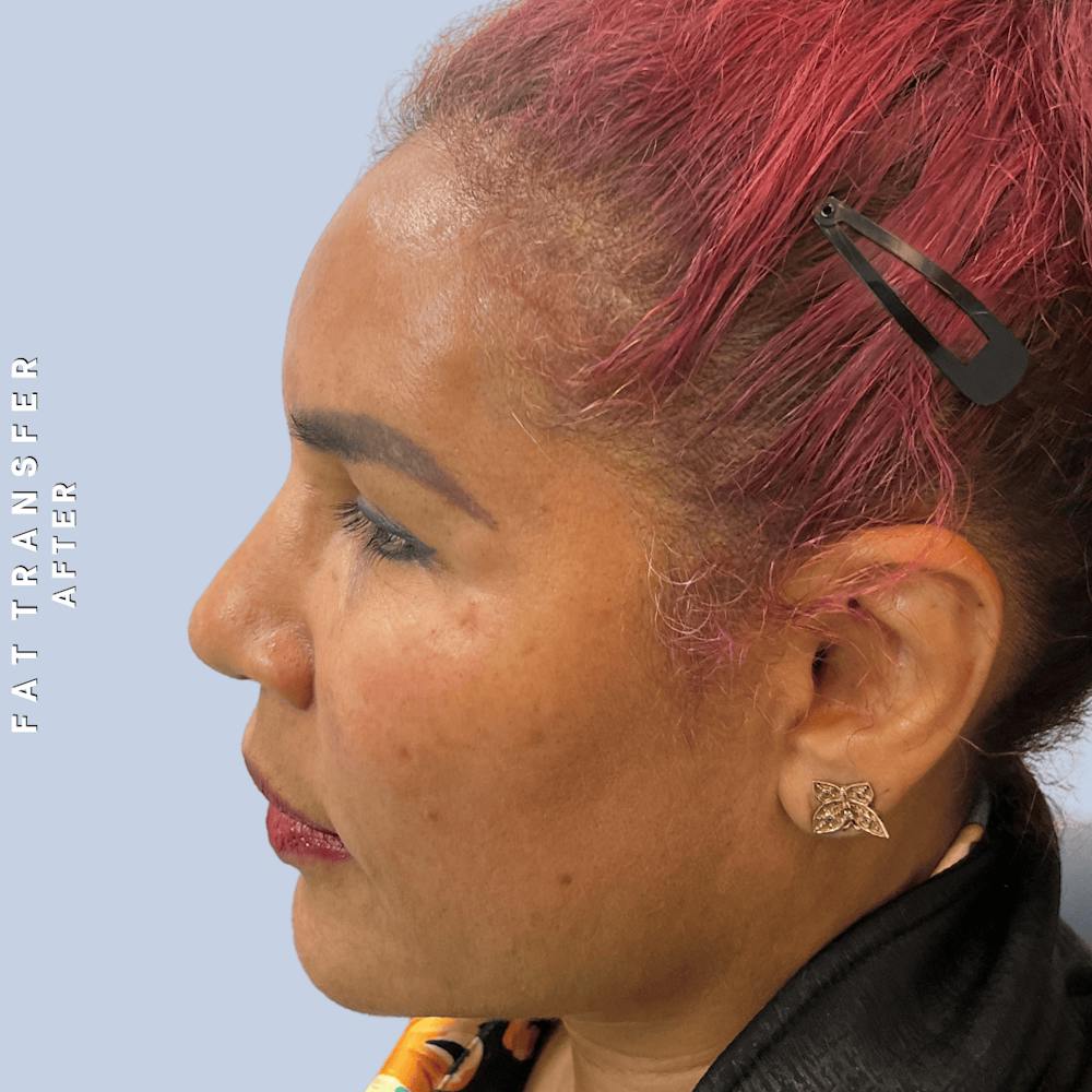 Other Before & After Gallery - Patient 277073 - Image 6