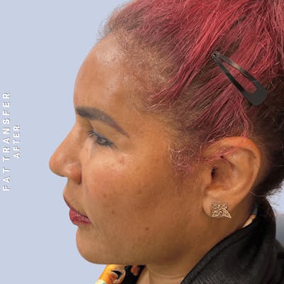 Other Before & After Gallery - Patient 277073 - Image 6