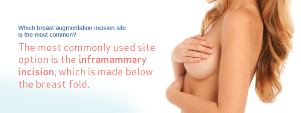 Breast Augmentation - Incision Site and Breast Implant Options - Irvine