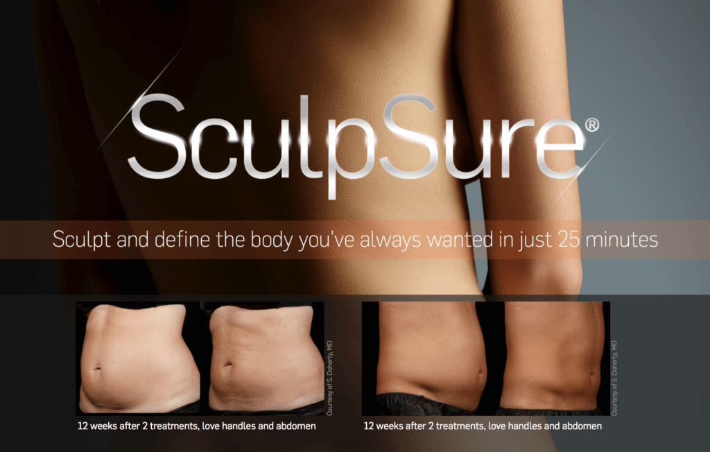 SculpSure Irvine before and after