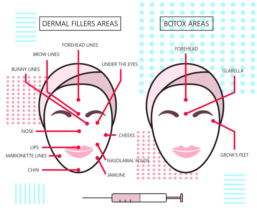 Dermal Fillers Vs Botox Irvine