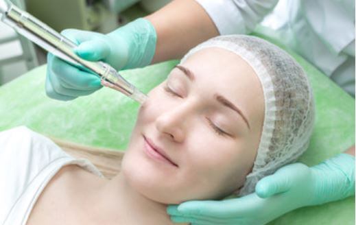 Microneedling Irvine