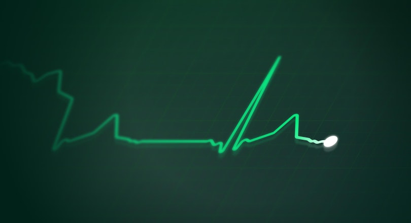 A stylized electrocardiogram (ECG or EKG) line showing a dramatic spike followed by a return to a more regular-looking rhythm.