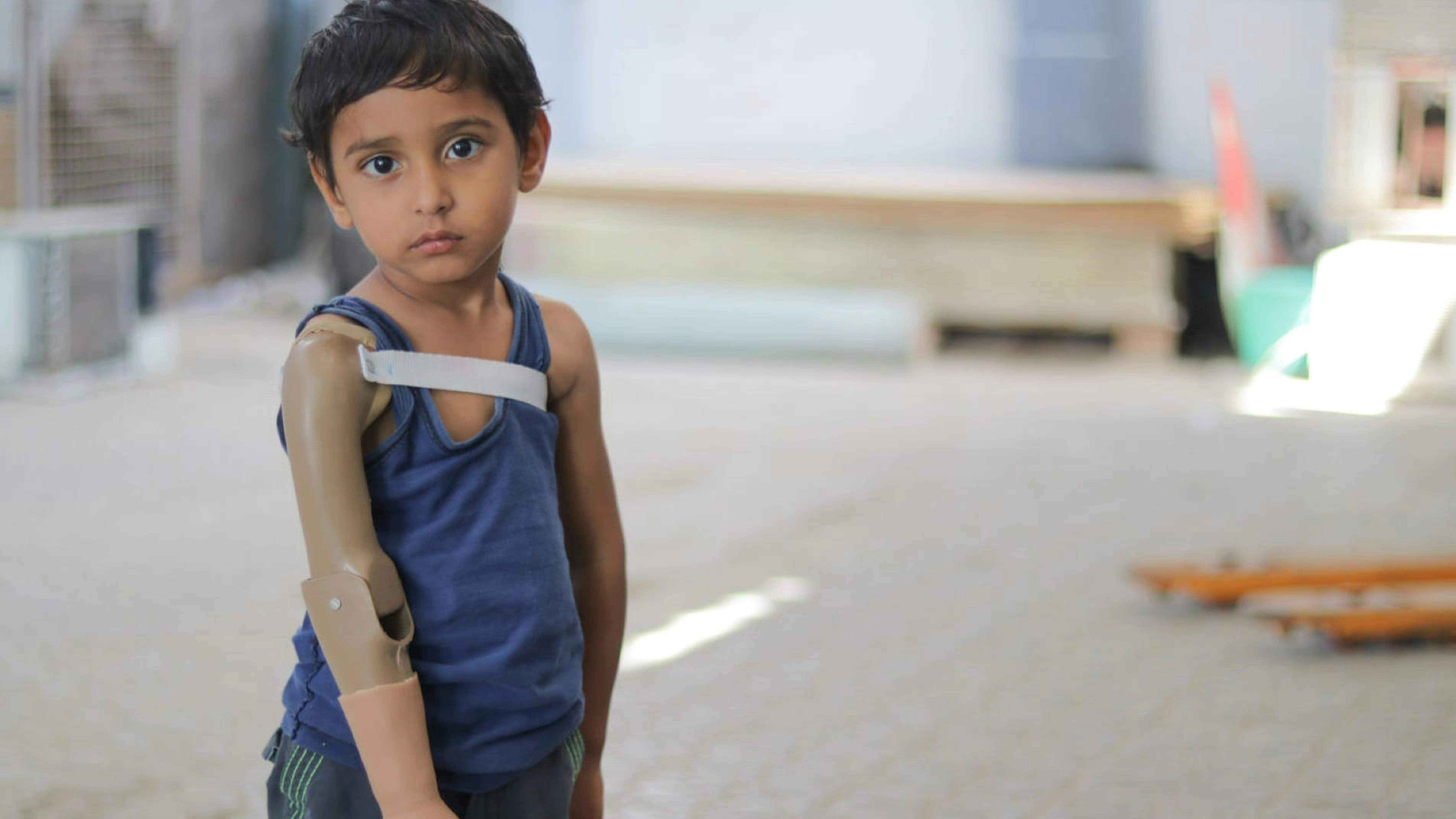 Rayan ha perso un braccio durante i combattimenti nello Yemen.