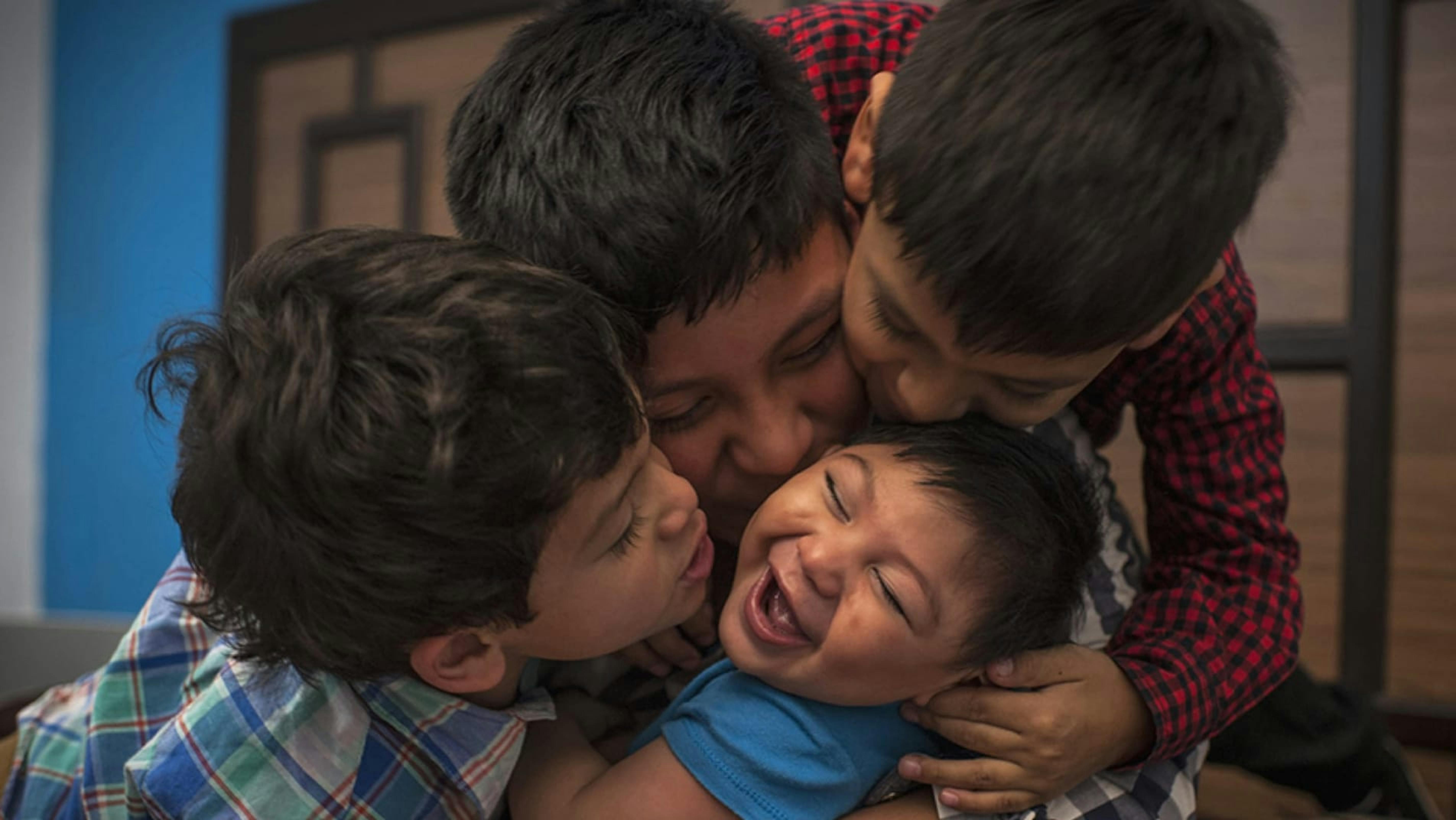 Danilo, 9 mesi, è nato con la sindrome da Zika congenita a Città del Guatemala.