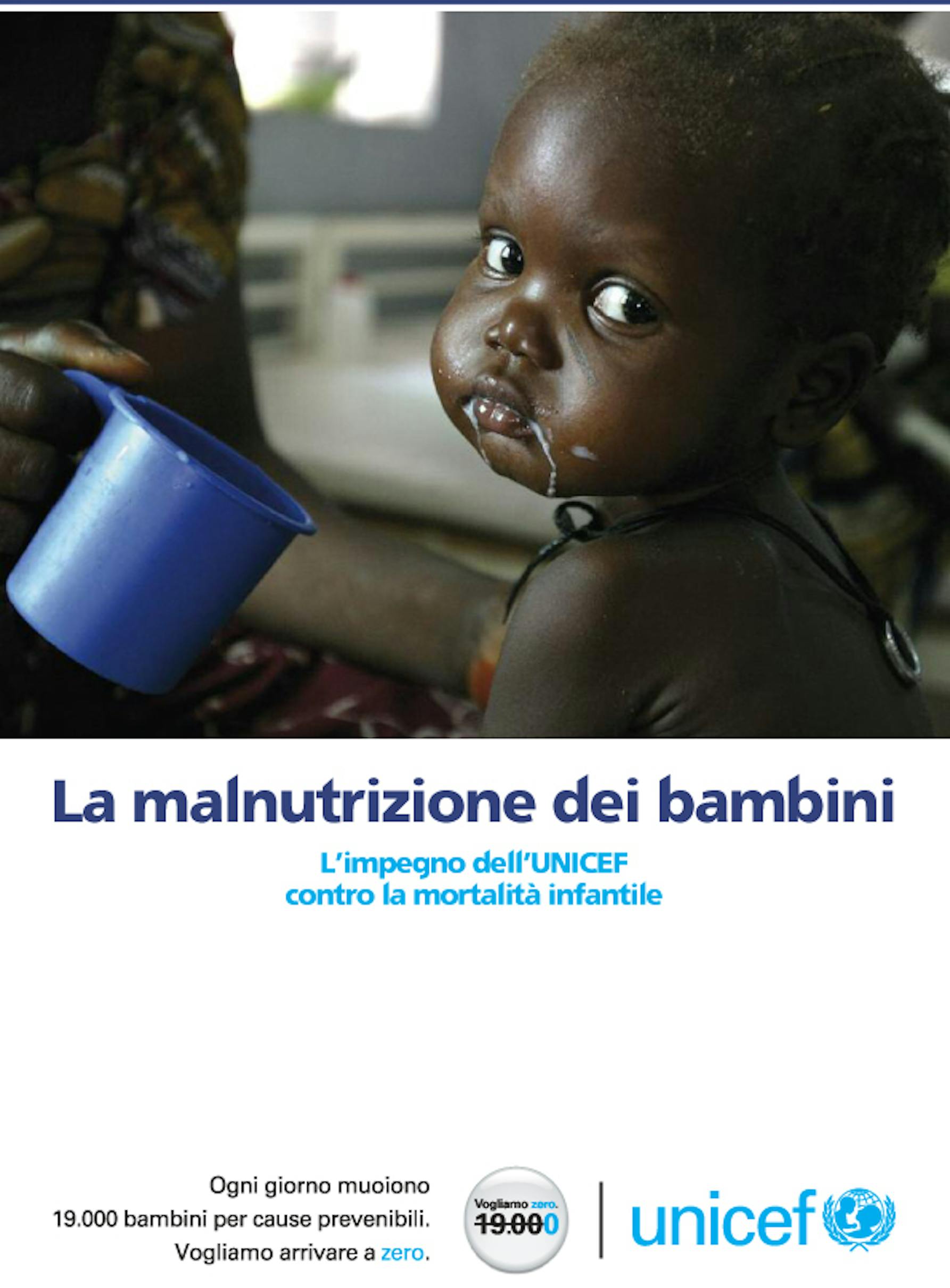 La malnutrizione dei bambini