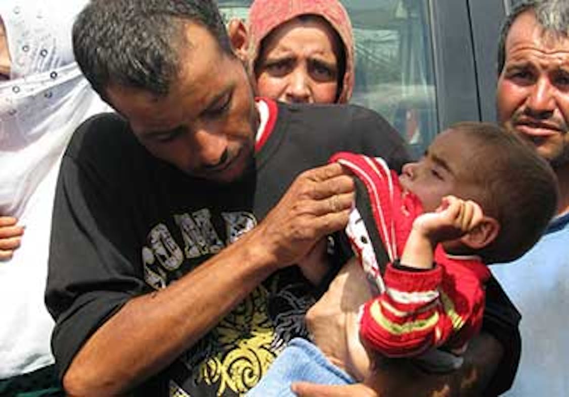 Il papà di Aisha mostra sua figlia sofferente, con le ossa sporgenti sul petto. Non è difficile capire che è affetta da malnutrizione. © UNICEF Lebanon 2013Azar