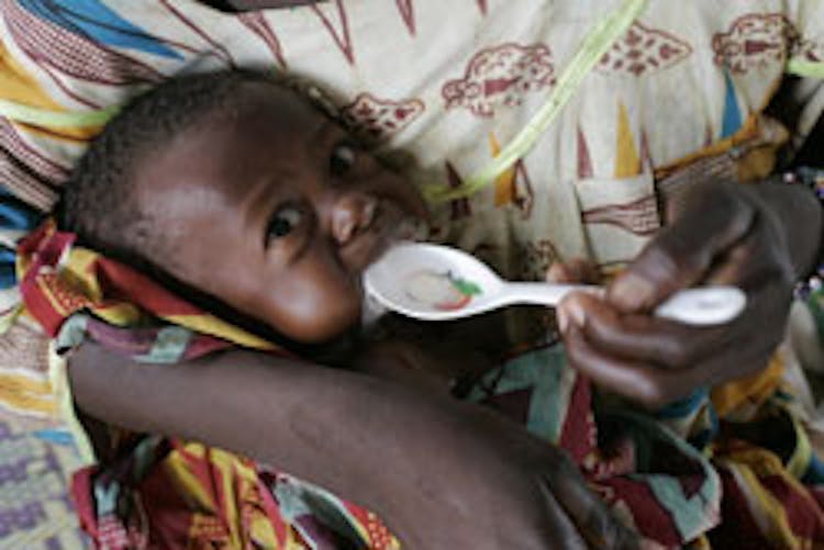 Un bambino gravemente malnutrito riceve una dose di latte terapeutico nel Centro nutrizionale di Maradi (Niger)