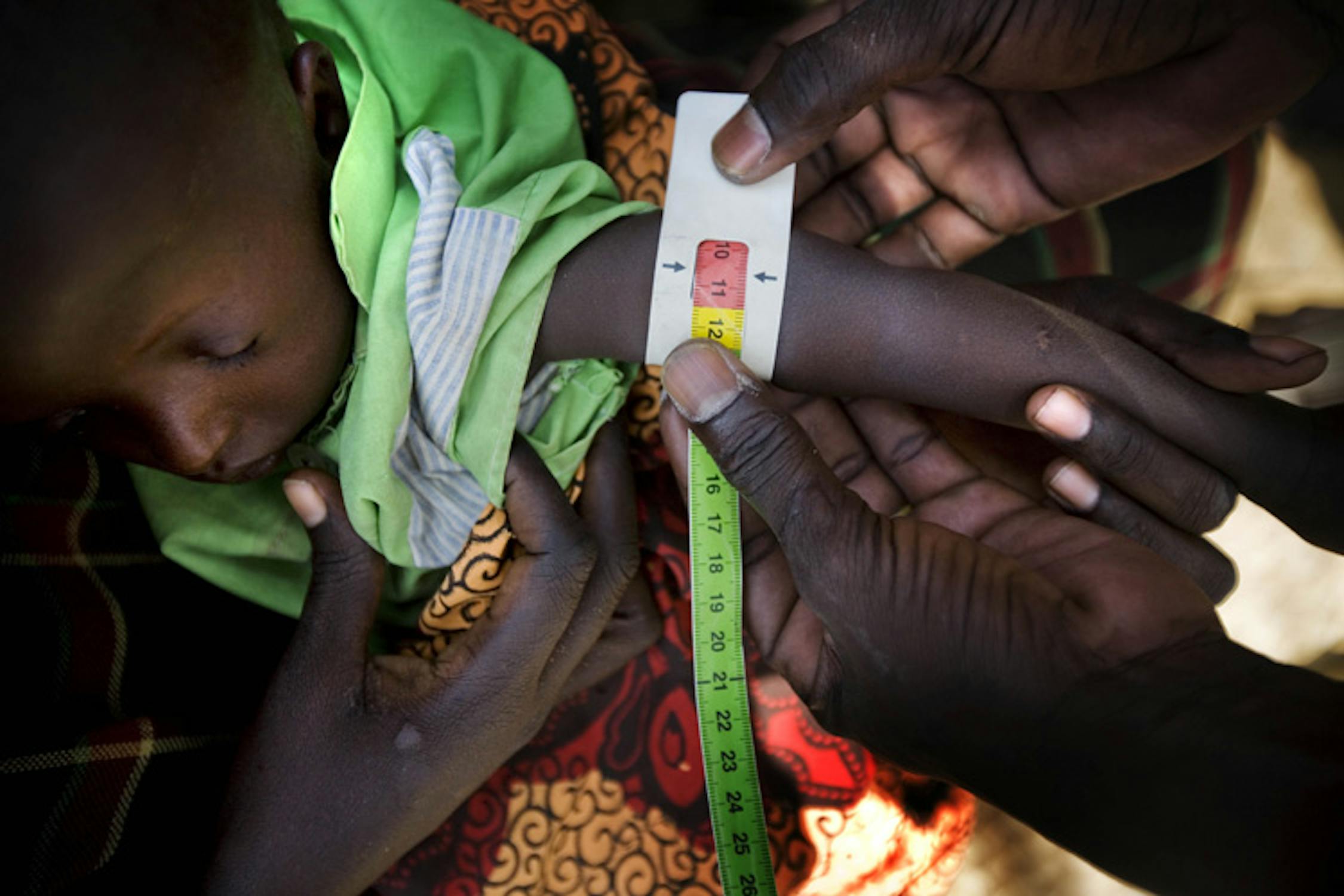 Un'infermiera misura la circonferenza del polso di un bambino nel villaggio di Longelop, nella regione somala del Turkana: la sezione rossa del braccialetto indica che il bambino è affetto da malnutrizione grave - ©UNICEF/NYHQ2011-1108/K.Holt
