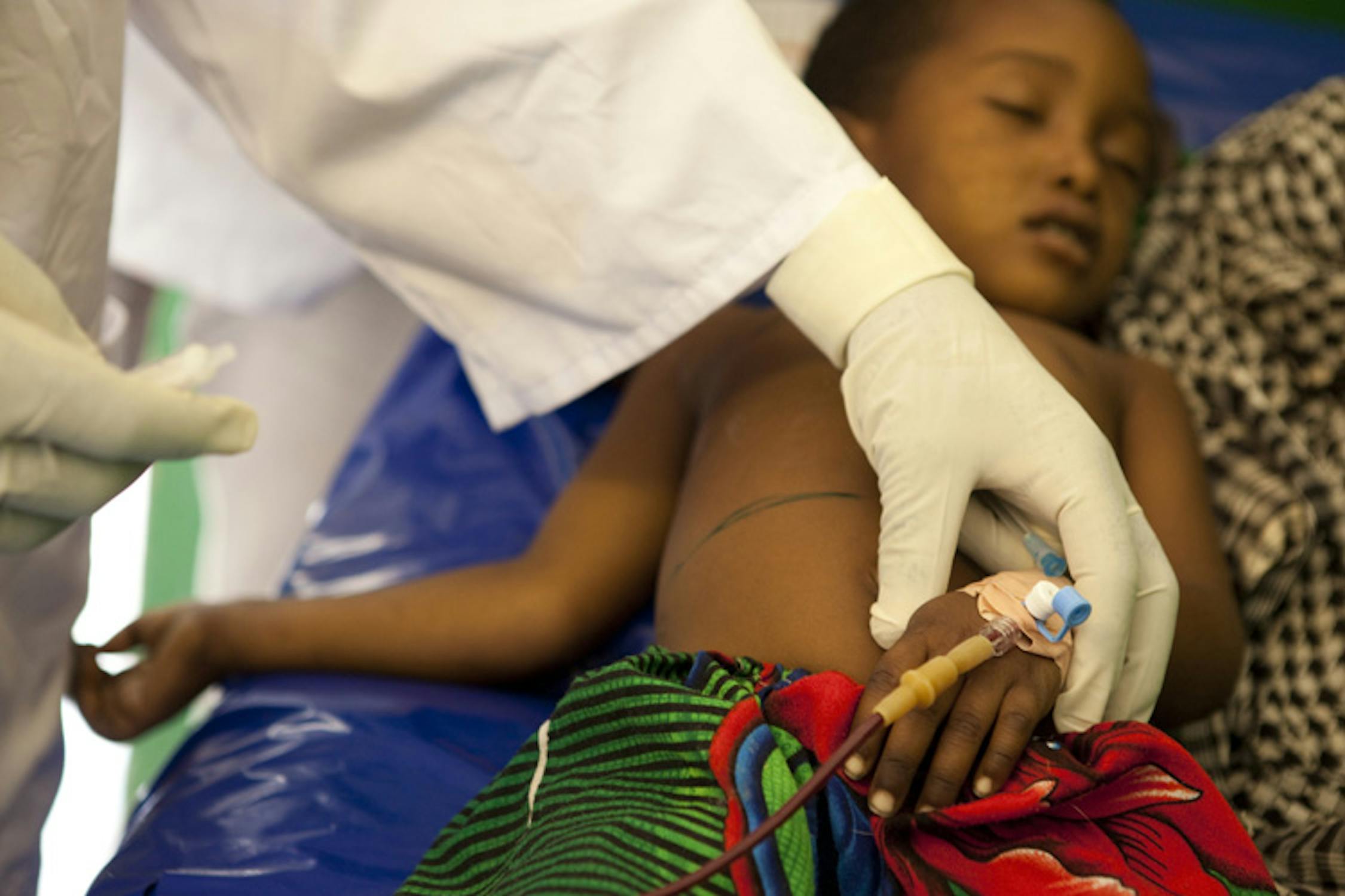 Cure a una bambina affetta da malnutrizione in un centro sanitario finanziato dall'UNICEF a Koukou Angarana, nel sud-est del Ciad - ©UNICEF/NYHQ2011-2165/Esteve