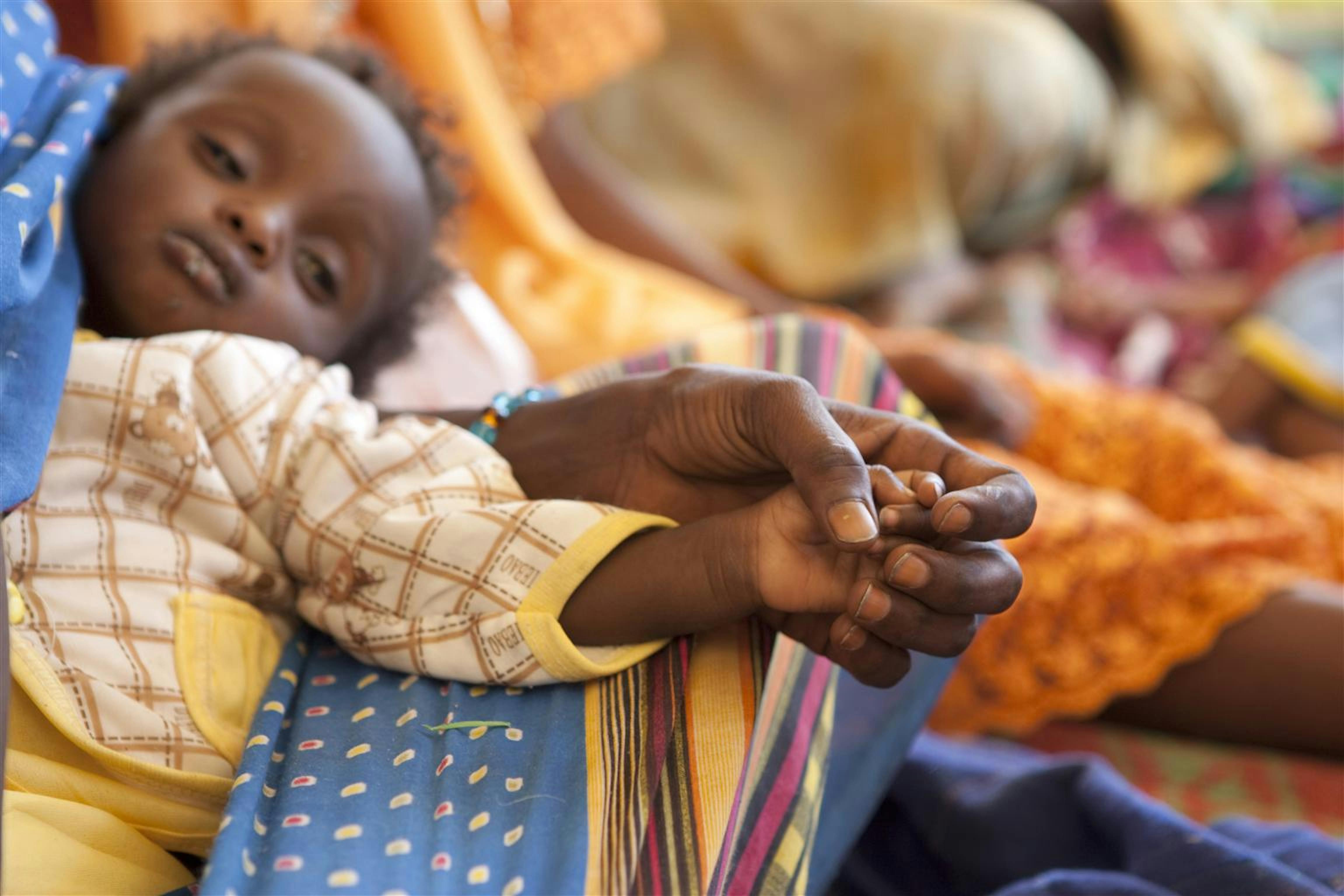 Un bambino in cura per un grave stato di denutrizione in un Centro nutrizionale terapeutico dell'UNICEF a Mao (Ciad) - ©UNICEF/NYHQ2011-2173/P.Esteve