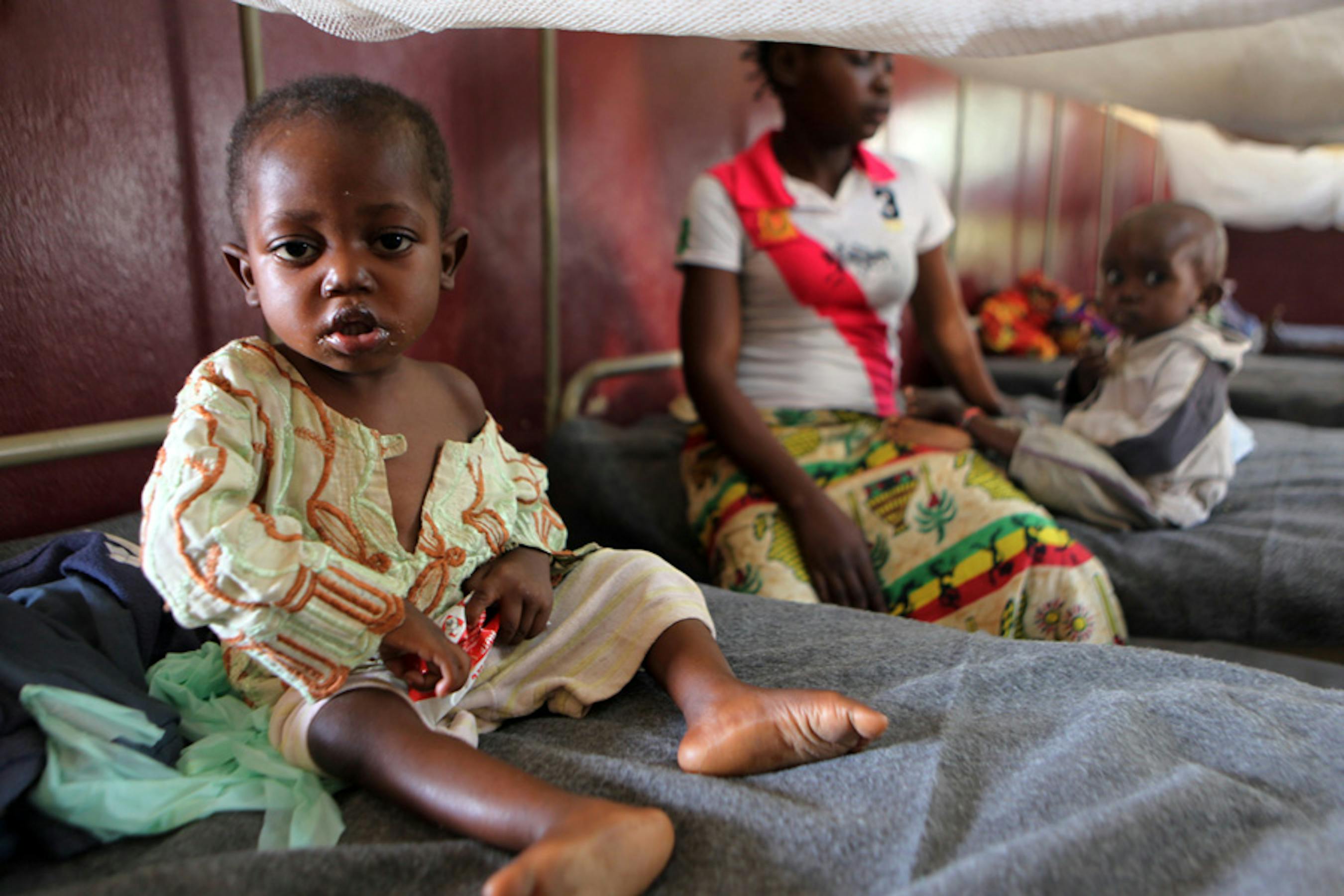 Un bambino ricoverato nel centro terapeutico nutrizionale dell'Ospedale pediatrico di Bangui, capitale della Repubblica Centrafricana - ©UNICEF/NYHQ2013-1289/Terdjman