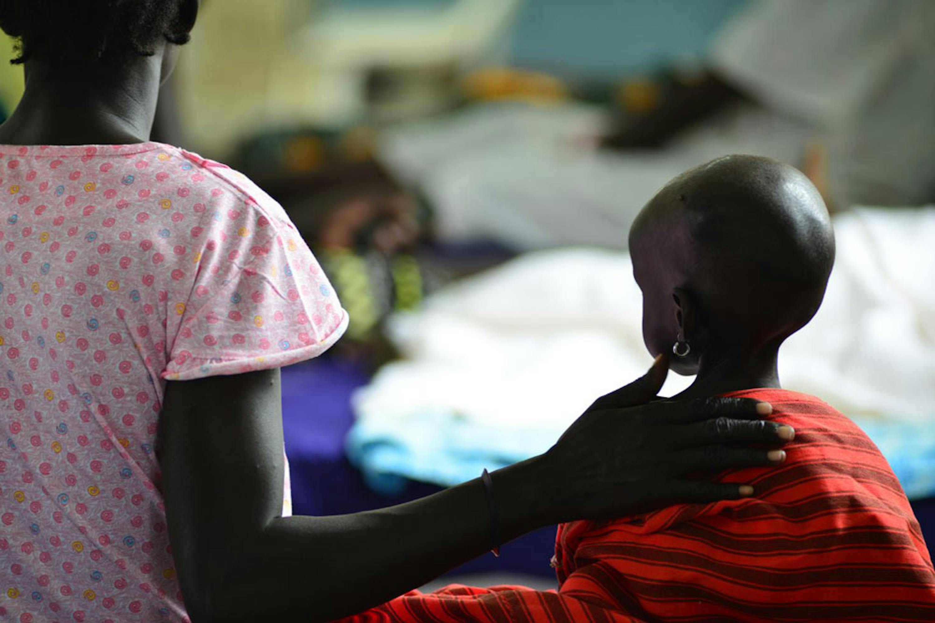 Nyanwot Lam, 2 anni, è una delle decine di migliaia di bambini che rischiano la morte per malnutrizione nel Sud Sudan a causa del conflitto che dilania il paese - ©UNICEF/NYHQ2014-1132/Nesbitt